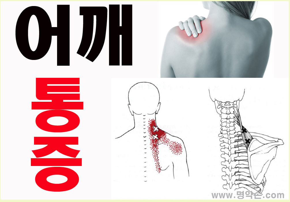 어깨통증마사지/어깨통증개선/명약손 인천마사지